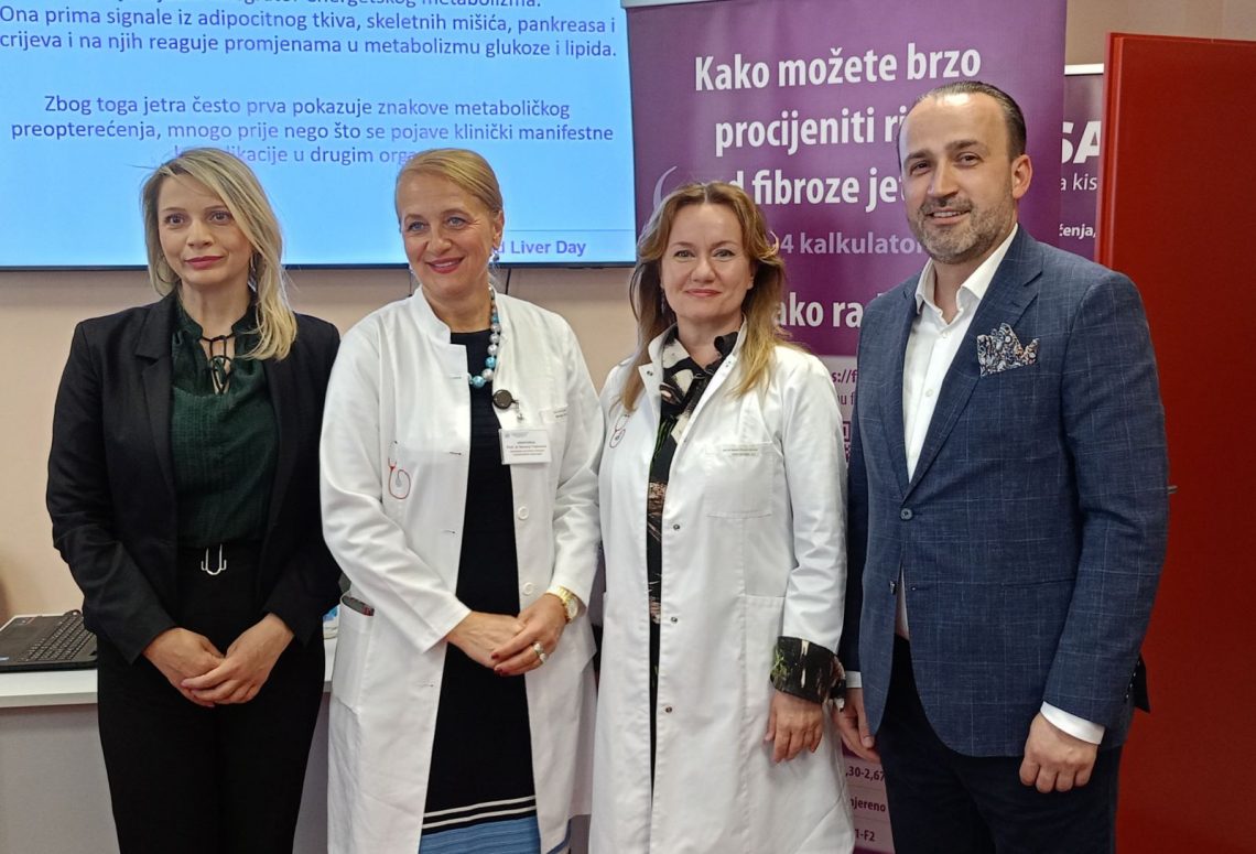 Obilježen Svjetski dan jetre u Domu zdravlja Banja Luka – 19. april