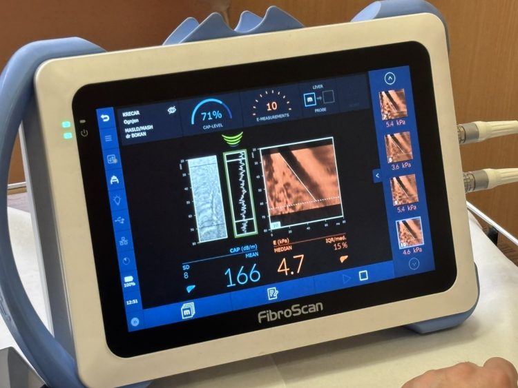 Obilježen Svjetski dan jetre u Domu zdravlja Banja Luka – 19. april